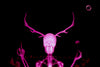 The Trophy (pink)
